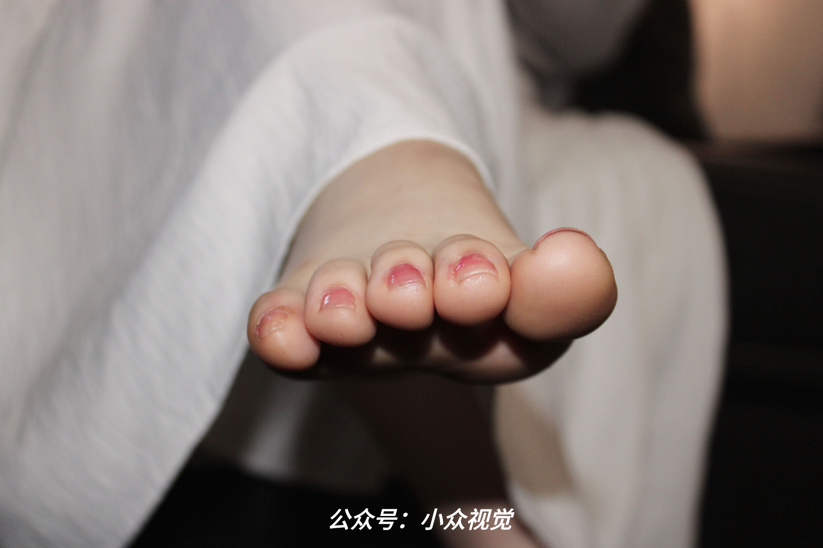 小众视觉 No.0022 小薯条/(101P)