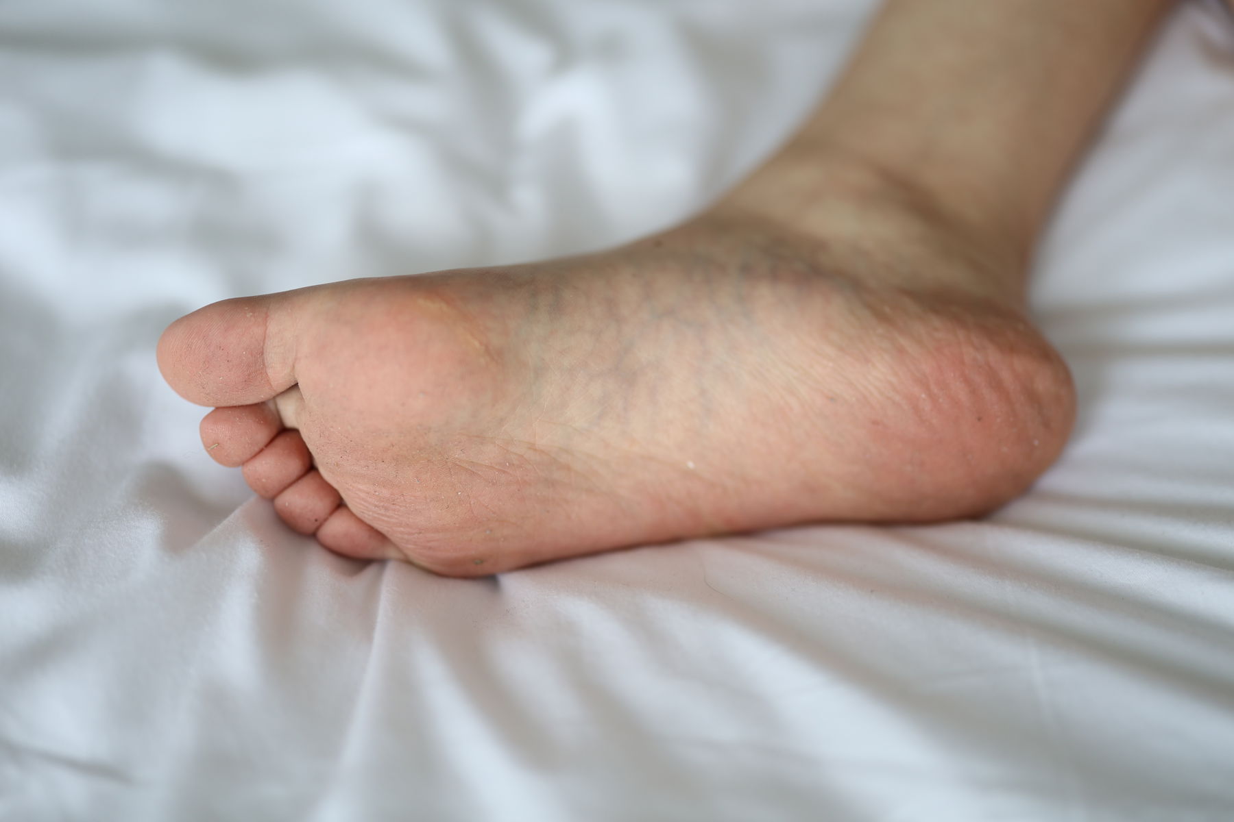 三禾摄影 No.005 肉丝大腿袜/(183P)