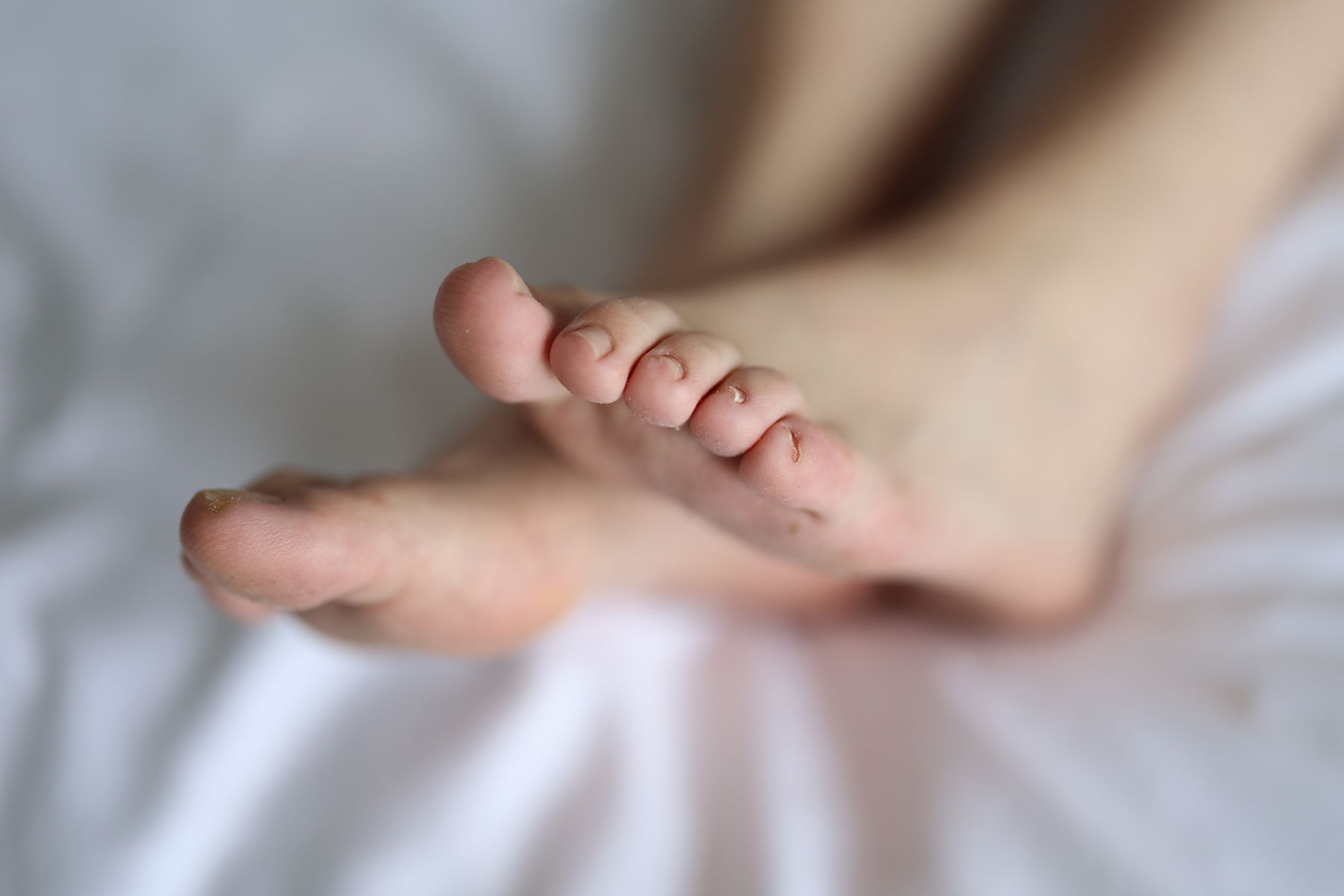 三禾摄影 No.005 肉丝大腿袜/(183P)