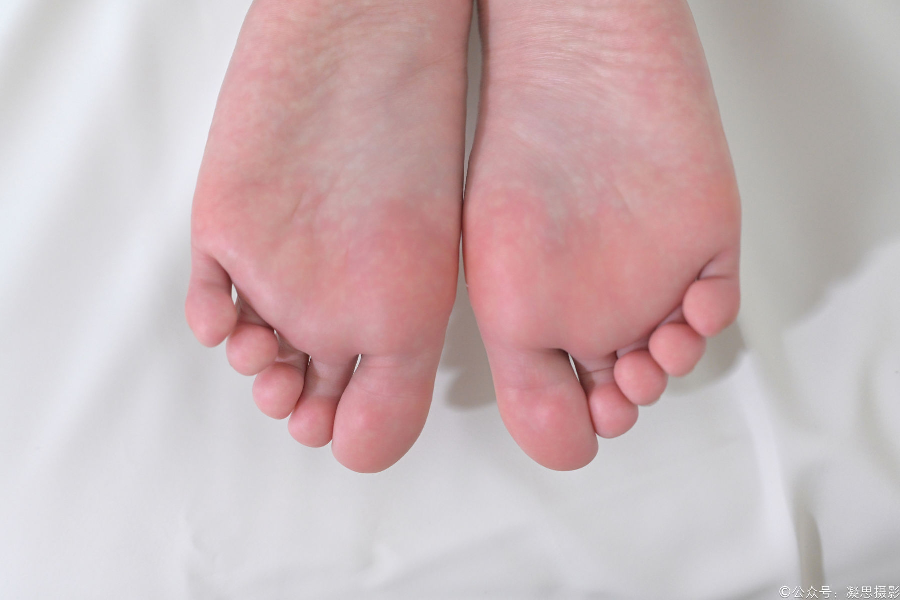 凝思摄影 No.008 铃铃 - 短裙、短白袜、小皮鞋/(158P)